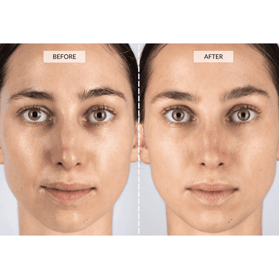 CurrentBody Skin Maska LED do terapii światłem