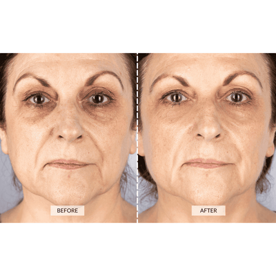CurrentBody Skin Maska LED do terapii światłem