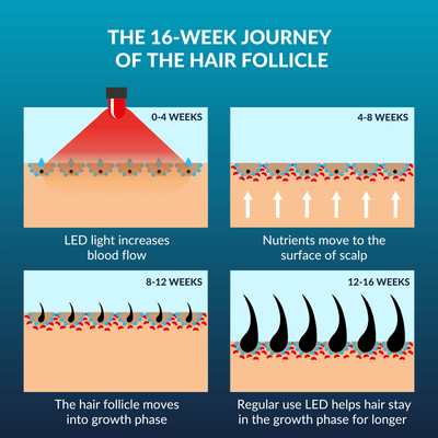 CurrentBody Skin LED Hair Regrowth - urządzenie na porost włosów