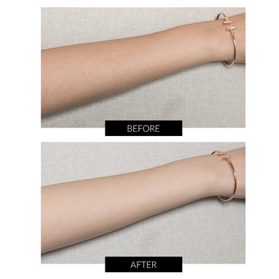 JOVS Mini Hair Removal Device - Wyłącznie w CurrentBody Skin