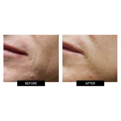 ZIIP Beauty Nanocurrent Device Before and After Review